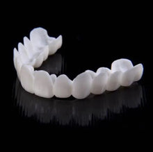 Load image into Gallery viewer, Heresio™ Snap-On Dentures
